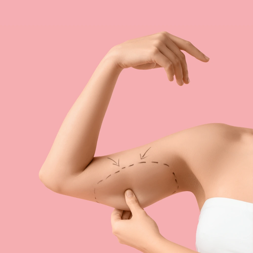 Upper arm body contouring treatment area