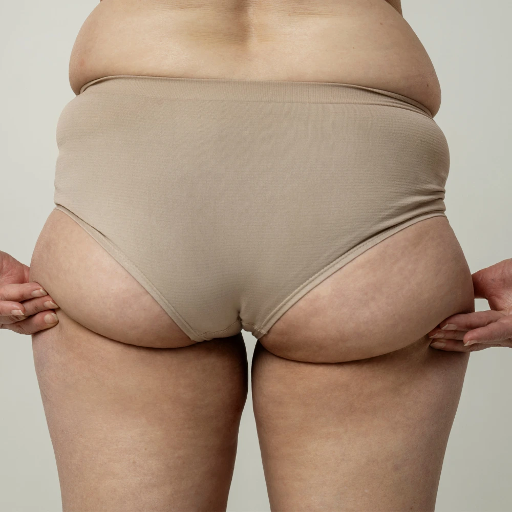 Hips consultation area for body concerns at LAVAĒ Sculpt Singapore