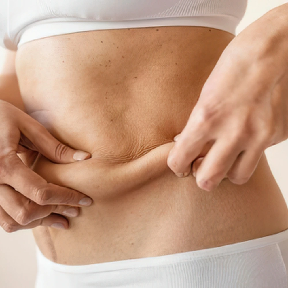 Skin Tightening consultation at LAVAĒ Sculpt Singapore