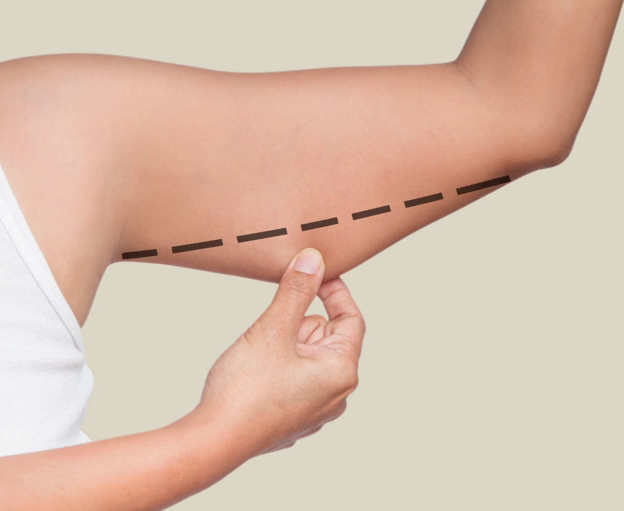 How to slim arms in Singapore