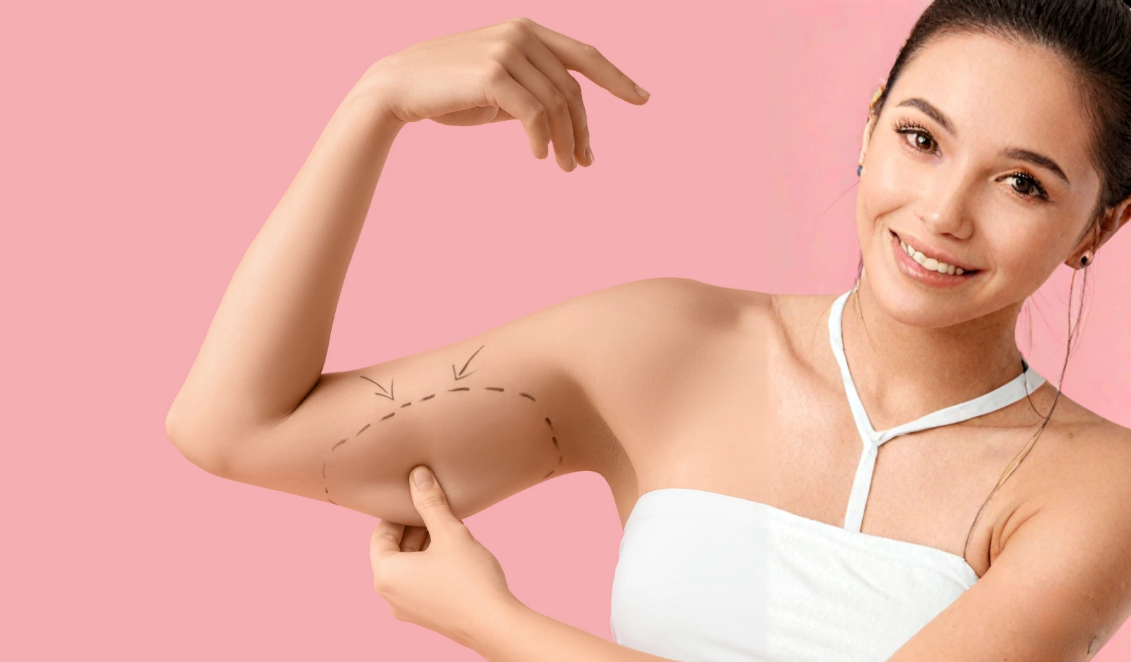 Close-up of upper arms representing arm slimming and body contouring in Singapore