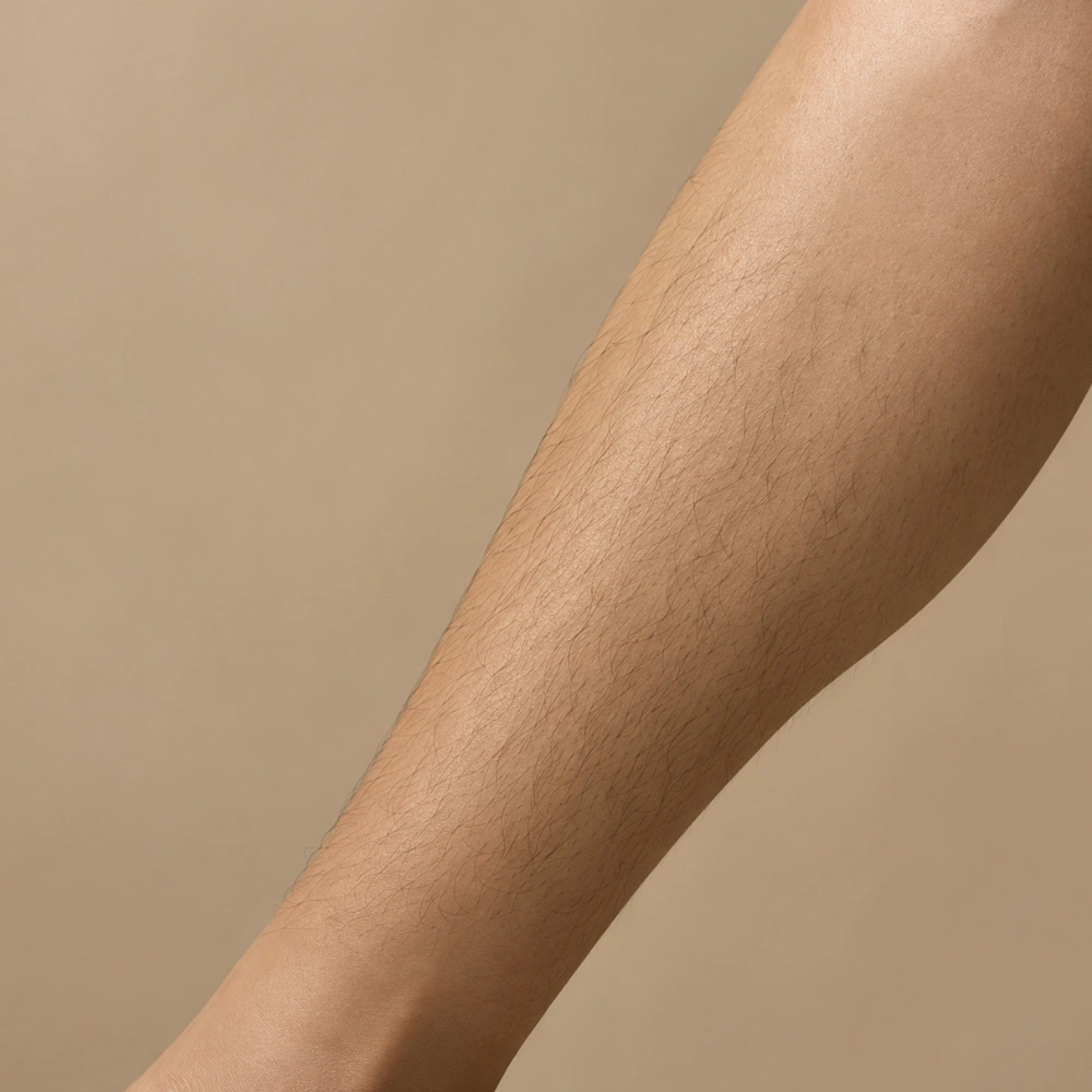 Unwanted hair treatment area