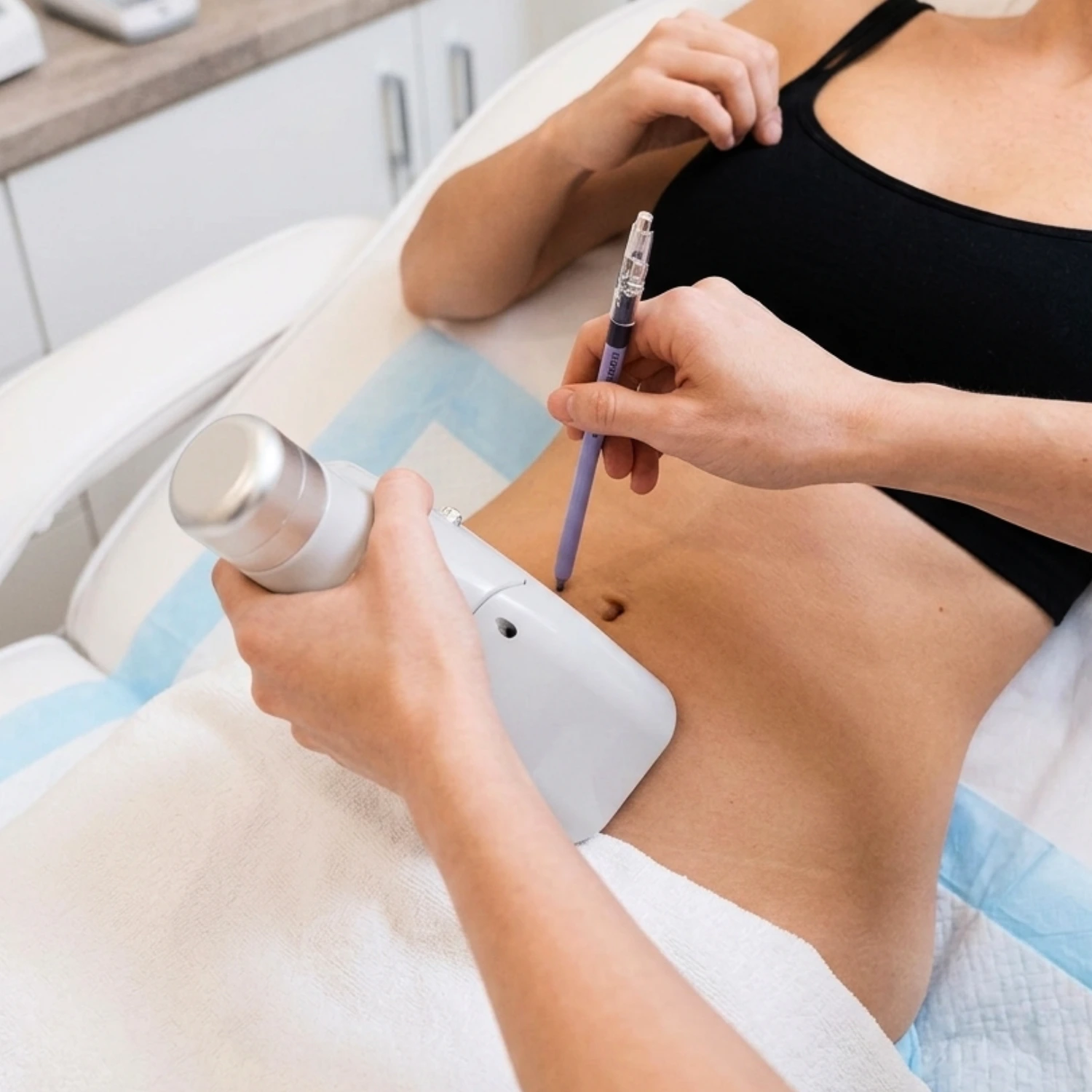 Cryo 360 Fat Freeze