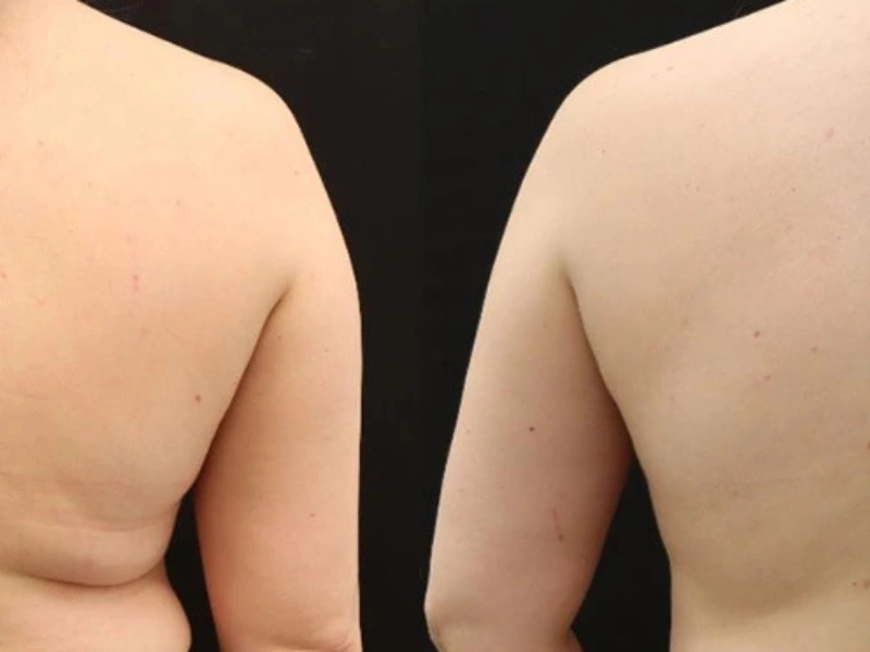 CurvX Sculpt before and after result