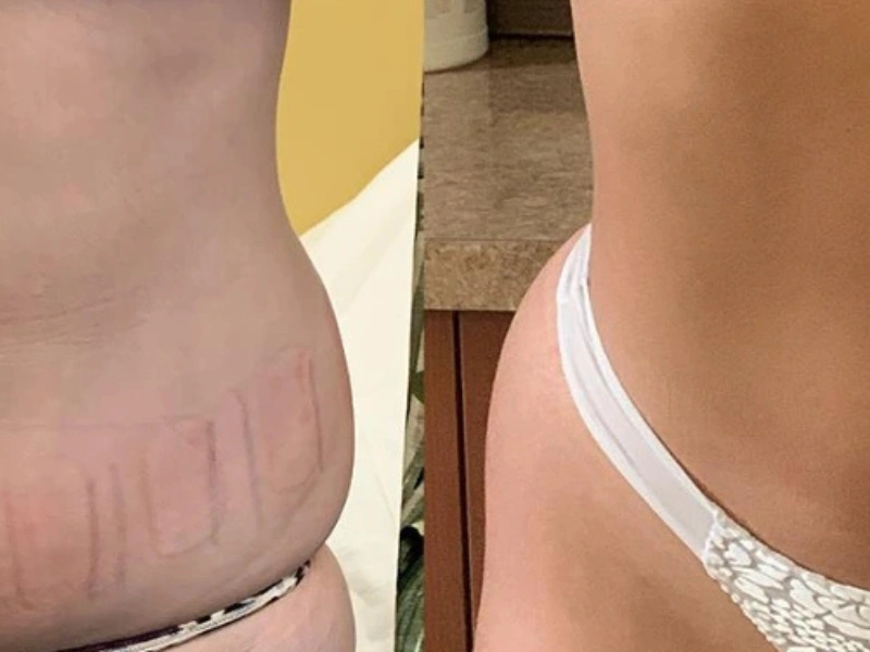 CurvX Sculpt before and after result