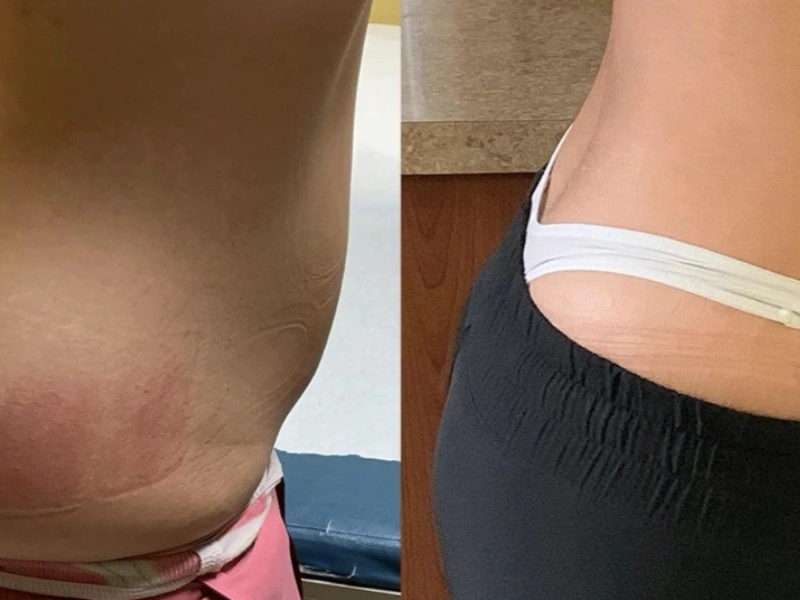 CurvX Sculpt before and after result