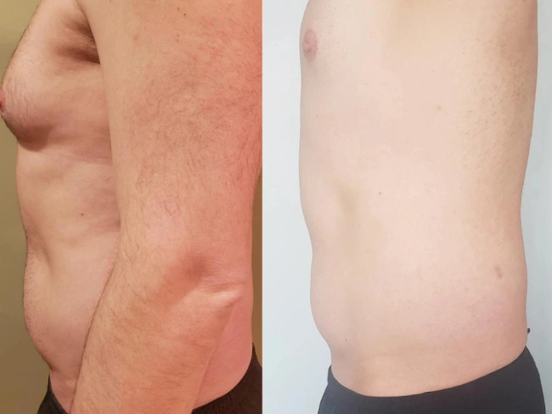 CurvX Sculpt before and after result