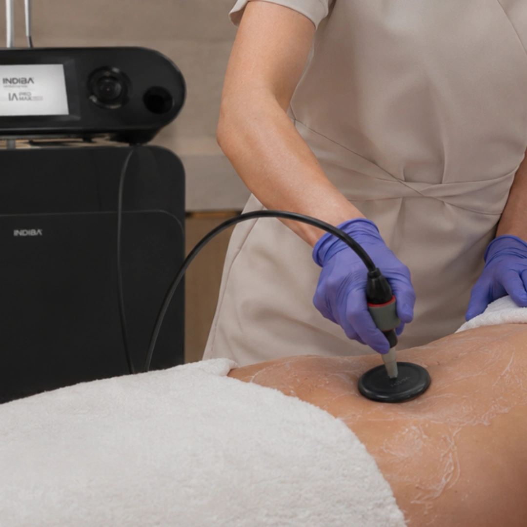 INDIBA IA Pro Max body wellness treatment at LAVAĒ Sculpt Singapore