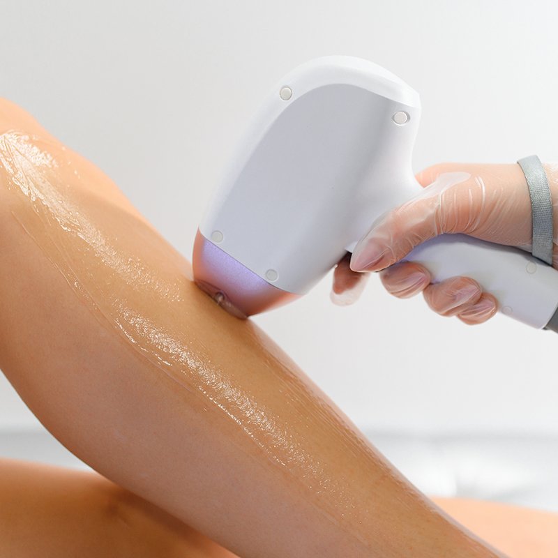 Experience information for SHR Hair Removal at LAVAĒ Sculpt
